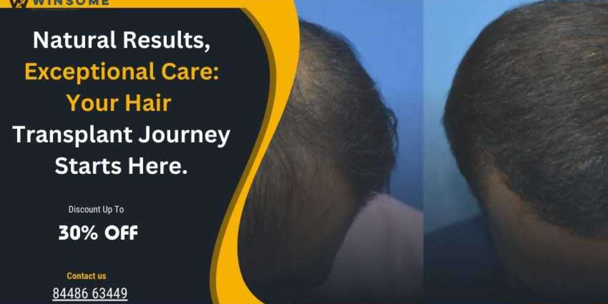 Natural Results, Exceptional Care: Your Hair Transplant Journey Starts Here