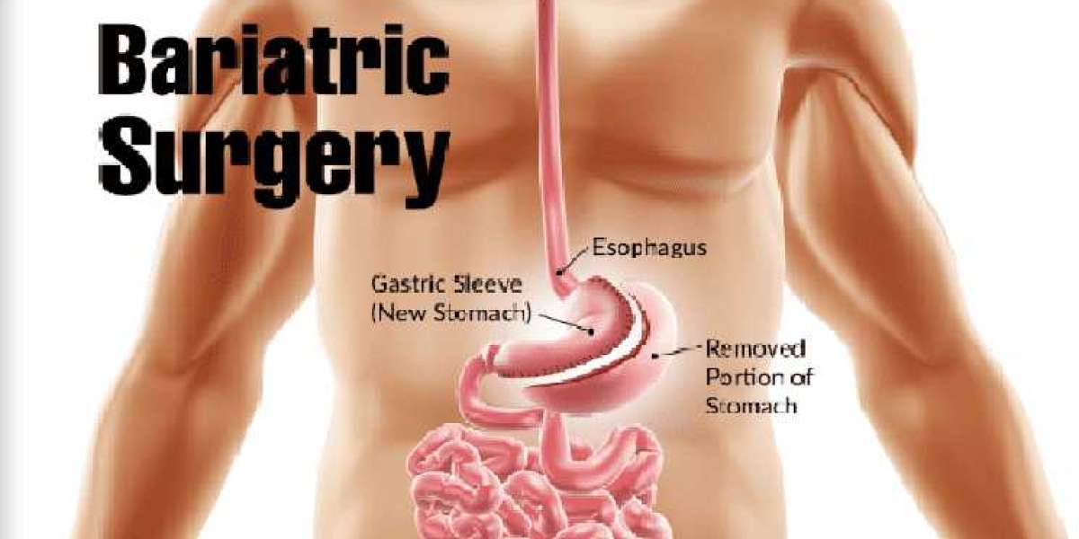 What Lifestyle Changes Are Required After Bariatric Surgery?